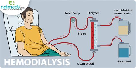 The Different Ways To Get Free Dialysis In The .